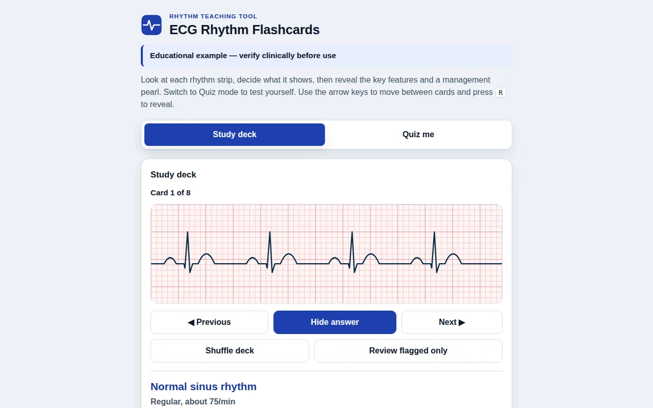 Screenshot of ECG Rhythm Flashcards