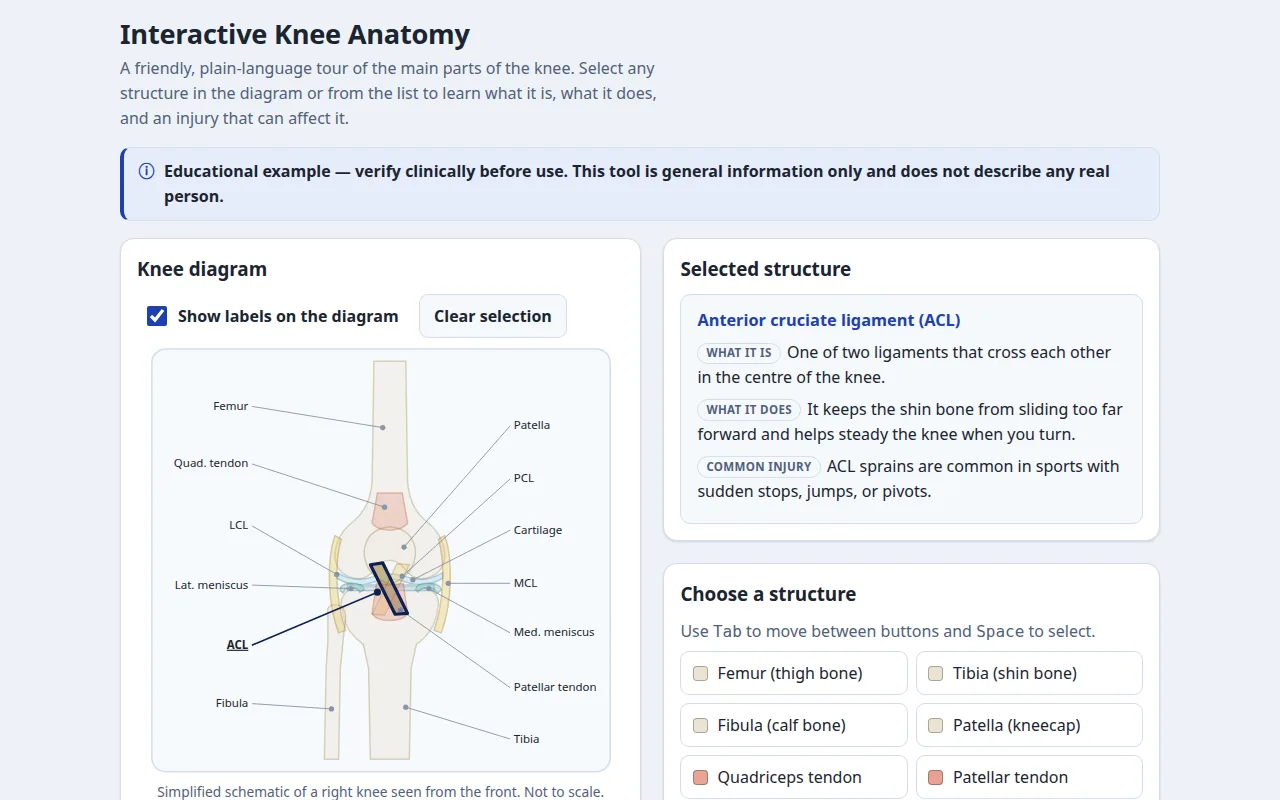 Screenshot of Interactive Knee Anatomy